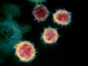 NIH clinical trial of remdesivir to treat COVID-19 begins
